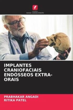 IMPLANTES CRANIOFACIAIS ENDÓSSEOS EXTRA-ORAIS - Angadi, Prabhakar;Patel, Ritika