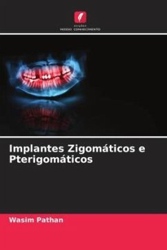 Implantes Zigomáticos e Pterigomáticos - Pathan, Wasim