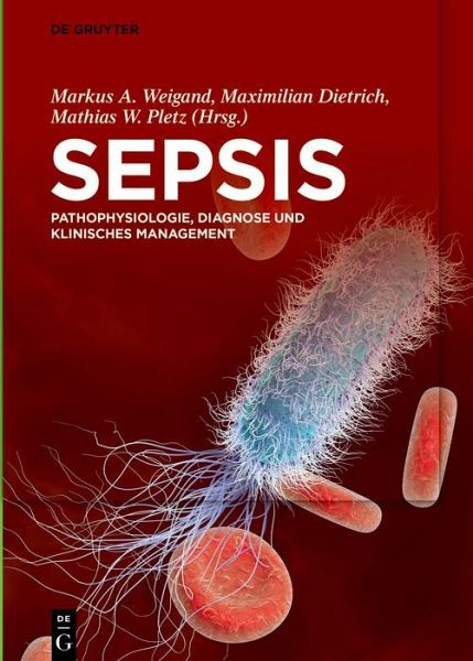 Sepsis (eBook, ePUB)