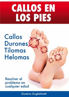 CALLOS EN LOS PIES - Solución definitiva para Callos, Tilomas y Helomas. (eBook, ePUB) - Guglielmotti, Gustavo