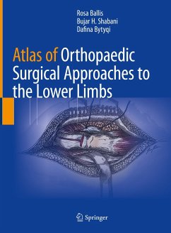 Atlas of Orthopaedic Surgical Approaches to the Lower Limbs (eBook, PDF) - Ballis, Rosa; Shabani, Bujar H.; Bytyqi, Dafina