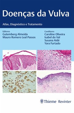 Doenças da Vulva (eBook, ePUB) - Almeida, Gutemberg; Passos, Mauro Romero Leal