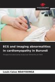 ECG and imaging abnormalities in cardiomyopathy in Burundi