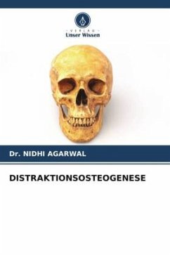DISTRAKTIONSOSTEOGENESE - AGARWAL, Dr. NIDHI