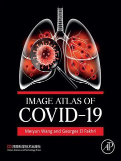 Cover Image Atlas of COVID-19 (eBook, ePUB)