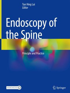 Endoscopy of the Spine