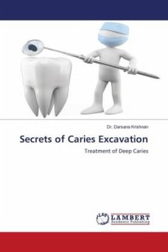 Secrets of Caries Excavation - Krishnan, Dr. Darsana