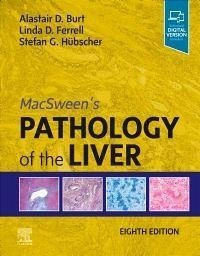 Macsween's Pathology of the Liver - Burt, Alastair D; Ferrell, Linda D; Hübscher, Stefan G