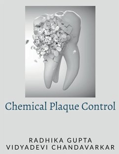 Chemical Plaque Control - Gupta, Radhika