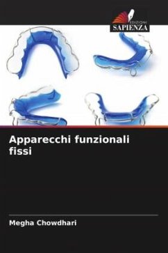 Apparecchi funzionali fissi - Chowdhari, Megha