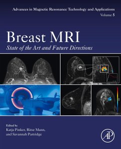 Breast MRI (eBook, ePUB)