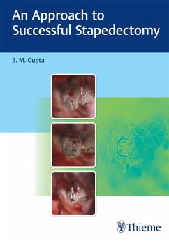 An Approach to Successful Stapedectomy (eBook, ePUB) - Gupta, B. M.