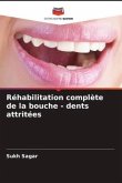 Réhabilitation complète de la bouche - dents attritées