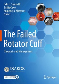 The Failed Rotator Cuff