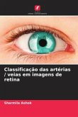 Classificação das artérias / veias em imagens de retina