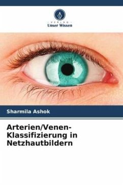 Arterien/Venen-Klassifizierung in Netzhautbildern - Ashok, Sharmila