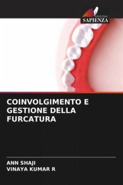 COINVOLGIMENTO E GESTIONE DELLA FURCATURA - Shaji, Ann;KUMAR R, VINAYA