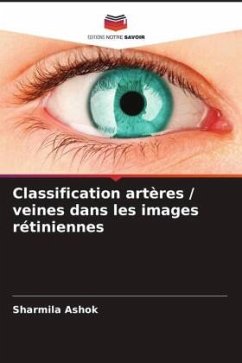 Classification artères / veines dans les images rétiniennes - Ashok, Sharmila