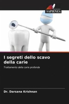 I segreti dello scavo della carie - Krishnan, Dr. Darsana