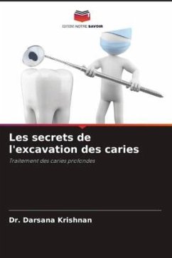 Cover Les secrets de l'excavation des caries