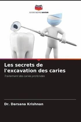 Les secrets de l'excavation des caries