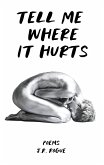 Tell Me Where It Hurts: Poems (eBook, ePUB)