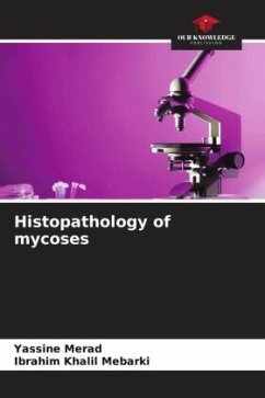 Histopathology of mycoses - Merad, Yassine;Mebarki, Ibrahim Khalil