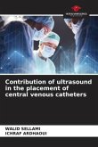 Contribution of ultrasound in the placement of central venous catheters
