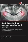 Denti impattati: un manuale conciso per i medici