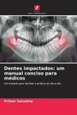 Dentes impactados: um manual conciso para médicos