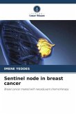 Sentinel node in breast cancer