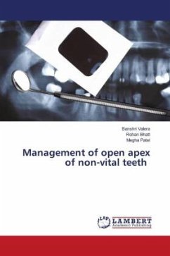 Management of open apex of non-vital teeth - Valera, Banshri;Bhatt, Rohan;Patel, Megha