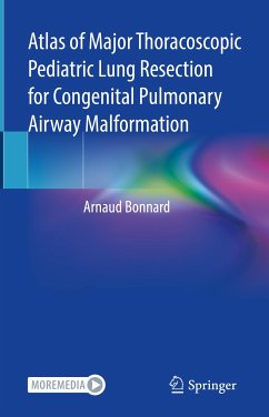 Atlas of Major Thoracoscopic Pediatric Lung Resection for Congenital Pulmonary Airway Malformation (eBook, PDF) - Bonnard, Arnaud