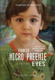 Those Micro Preemie Eyes