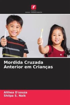 Mordida Cruzada Anterior em Crianças - D'souza, Althea;Naik, Shilpa S.