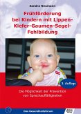 Frühförderung bei Kindern mit Lippen-Kiefer-Gaumen-Segel-Fehlbildung (eBook, PDF)