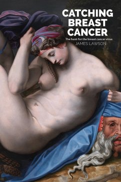 Cover Catching Breast Cancer (eBook, ePUB)