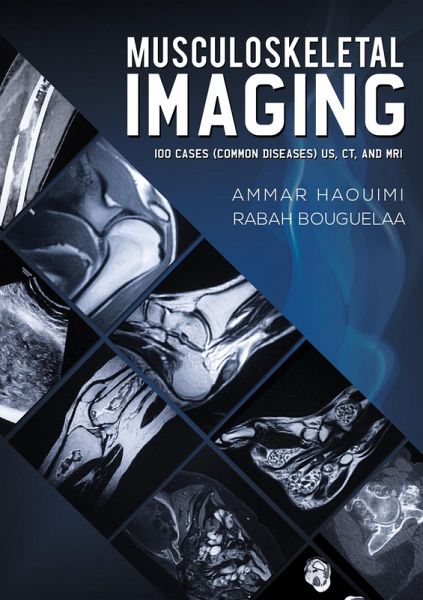 Musculoskeletal Imaging (eBook, ePUB) Musculoskeletal Imaging (eBook, ePUB)