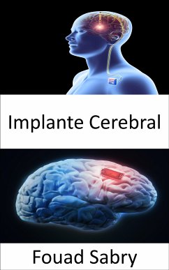Implante Cerebral (eBook, ePUB) - Sabry, Fouad