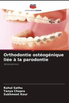 Orthodontie ostéogénique liée à la parodontie - Sathu, Rahul;Chopra, Tanya;Kour, Sukhmeet