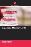 Expansão Maxilar Lenta