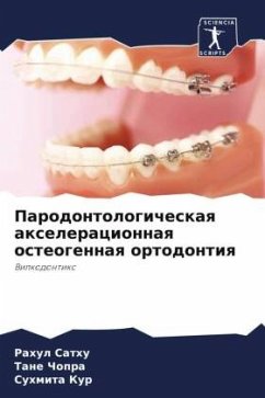 Parodontologicheskaq axeleracionnaq osteogennaq ortodontiq - Sathu, Rahul;Chopra, Tane;Kur, Suhmita
