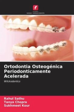 Ortodontia Osteogénica Periodonticamente Acelerada - Sathu, Rahul;Chopra, Tanya;Kour, Sukhmeet