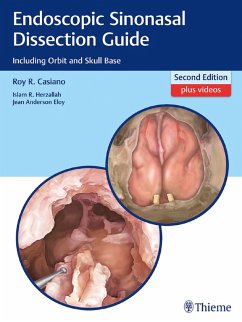 Endoscopic Sinonasal Dissection Guide (eBook, ePUB) - Casiano, Roy R.; Herzallah, Islam; Eloy, Jean