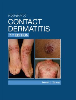 Fisher's Contact Dermatitis - 7th Edition (eBook, ePUB) - Fowler, Joseph F.