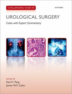 Challenging Cases in Urological Surgery - Pang, Karl; Catto, James