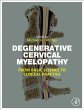 Degenerative Cervical Myelopathy - Bild 1