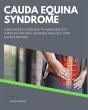 Cauda Equina Syndrome (eBook, ePUB) - Bild 1