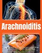 Arachnoiditis (eBook, ePUB) - Bild 1