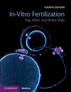 In-Vitro Fertilization (eBook, PDF) - Elder, Kay
